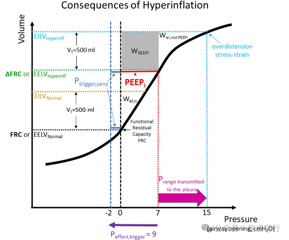 为什么成人呼吸机用容控重症哮喘和AECOPD患者的机械通气初始参数设置及策略_https://www.jmylbn.com_新闻资讯_第14张