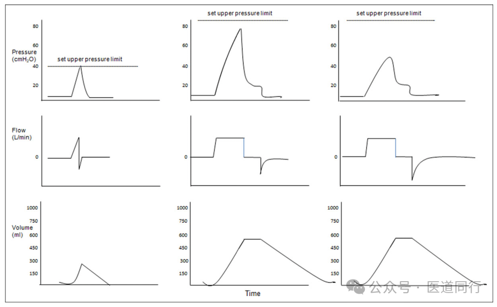 为什么成人呼吸机用容控重症哮喘和AECOPD患者的机械通气初始参数设置及策略_https://www.jmylbn.com_新闻资讯_第4张