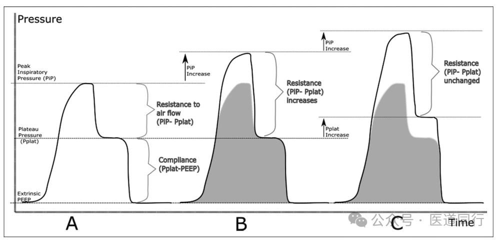 为什么成人呼吸机用容控重症哮喘和AECOPD患者的机械通气初始参数设置及策略_https://www.jmylbn.com_新闻资讯_第3张