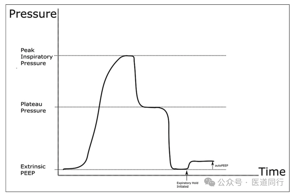 为什么成人呼吸机用容控重症哮喘和AECOPD患者的机械通气初始参数设置及策略_https://www.jmylbn.com_新闻资讯_第10张