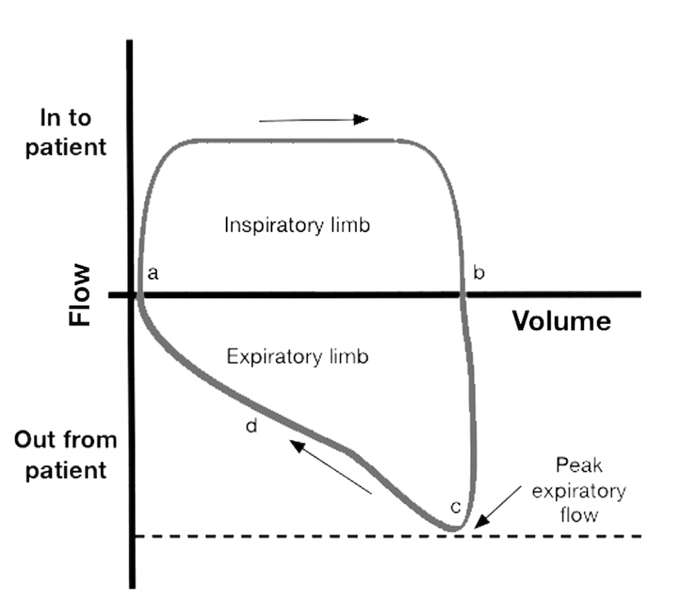 为什么成人呼吸机用容控呼吸机波形（Ventilator Waveforms 译文）_https://www.jmylbn.com_新闻资讯_第22张