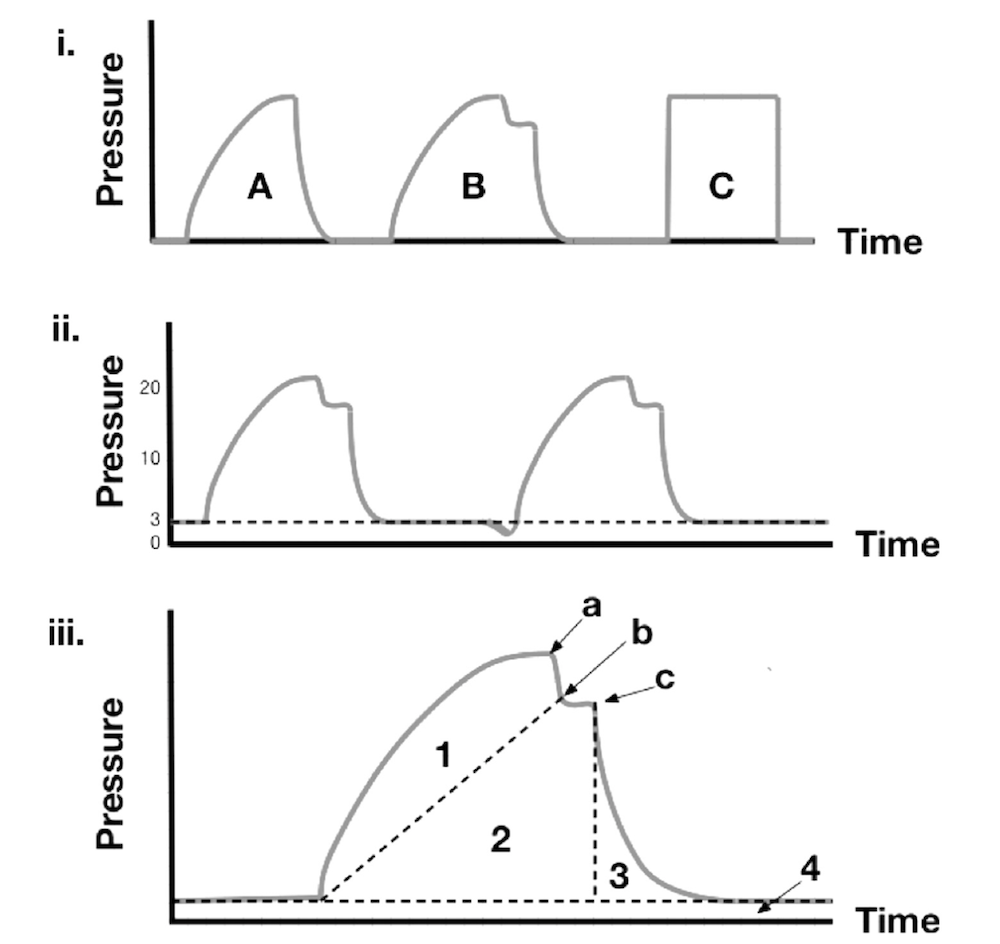 为什么成人呼吸机用容控呼吸机波形（Ventilator Waveforms 译文）_https://www.jmylbn.com_新闻资讯_第8张