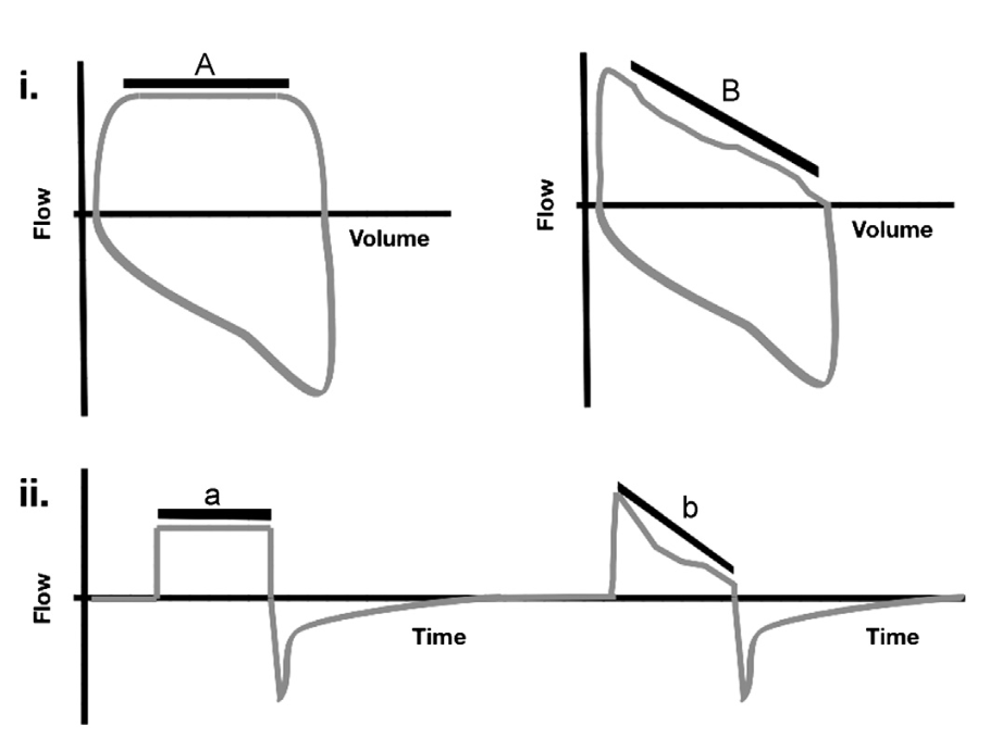 为什么成人呼吸机用容控呼吸机波形（Ventilator Waveforms 译文）_https://www.jmylbn.com_新闻资讯_第21张