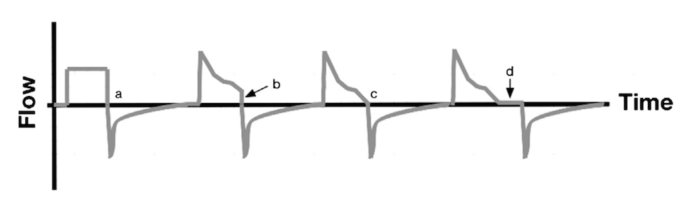 为什么成人呼吸机用容控呼吸机波形（Ventilator Waveforms 译文）_https://www.jmylbn.com_新闻资讯_第12张