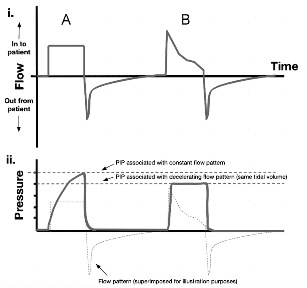 为什么成人呼吸机用容控呼吸机波形（Ventilator Waveforms 译文）_https://www.jmylbn.com_新闻资讯_第11张