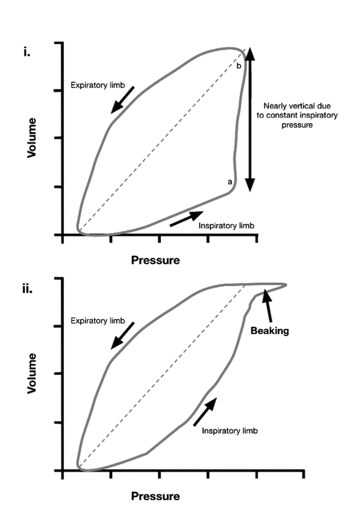 为什么成人呼吸机用容控呼吸机波形（Ventilator Waveforms 译文）_https://www.jmylbn.com_新闻资讯_第19张