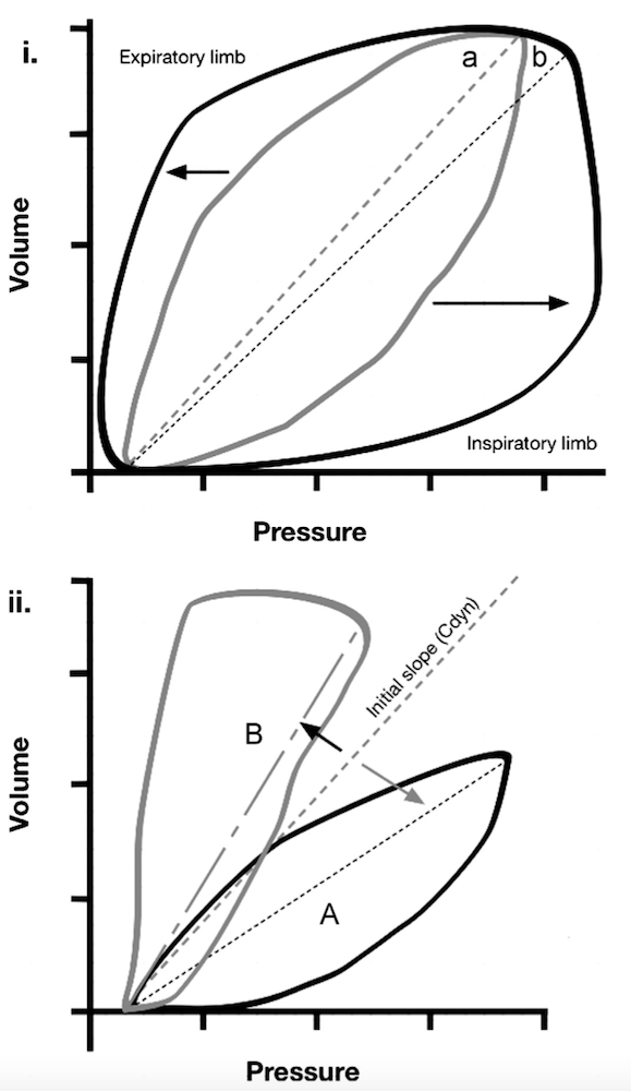 为什么成人呼吸机用容控呼吸机波形（Ventilator Waveforms 译文）_https://www.jmylbn.com_新闻资讯_第17张