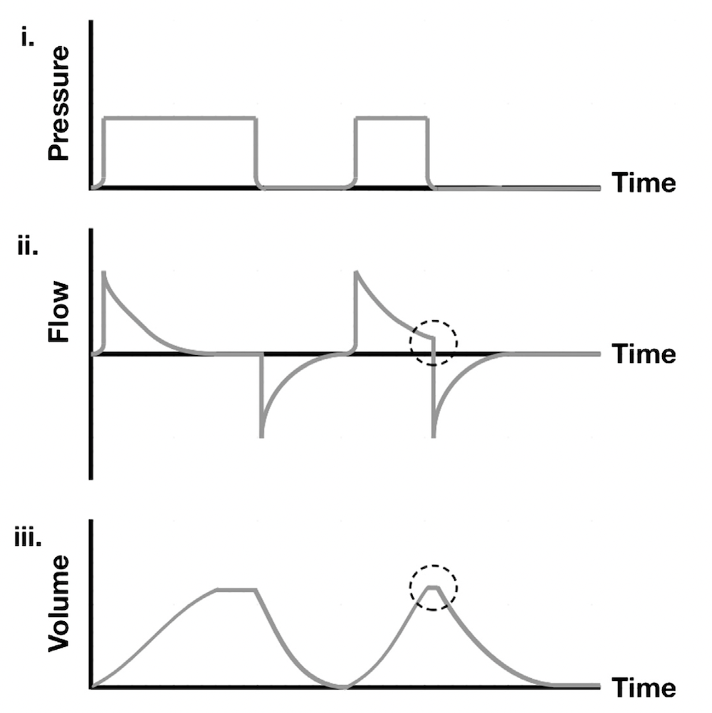 为什么成人呼吸机用容控呼吸机波形（Ventilator Waveforms 译文）_https://www.jmylbn.com_新闻资讯_第6张