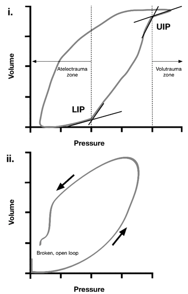 为什么成人呼吸机用容控呼吸机波形（Ventilator Waveforms 译文）_https://www.jmylbn.com_新闻资讯_第20张