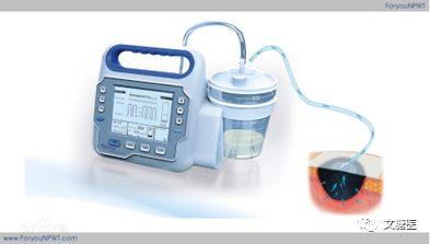 伤口负压治疗怎么收费【文糖医】负压伤口疗法在糖尿病足创面治疗的应用简介_https://www.jmylbn.com_新闻资讯_第2张