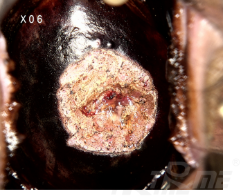 激光治疗仪能治什么病宫颈疾病患者的福音——仪征市中医院妇科成功引进二氧化碳激光治疗仪！_https://www.jmylbn.com_新闻资讯_第3张