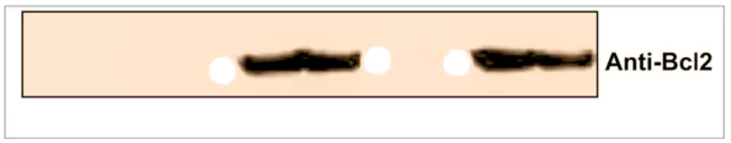 640?wx_fmt=png&wxfrom=5&wx_lazy=1&wx_co=1