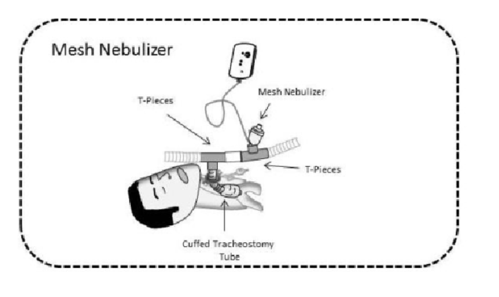 呼吸机雾化装置怎么用雾化器装置Nebulizer System——Aerogen  T型接头_https://www.jmylbn.com_新闻资讯_第11张