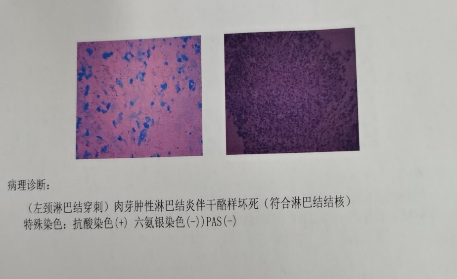 取病理什么意思病理报告为什么不能当天取？报告里的+-代表了什么？_https://www.jmylbn.com_新闻资讯_第5张