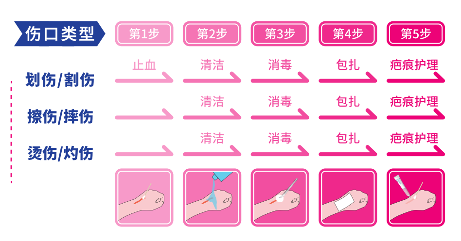 医用伤口护理膜怎么用Zhende爱护 ｜ 不同场景下的伤口该如何护理？一篇教会你！_https://www.jmylbn.com_新闻资讯_第12张