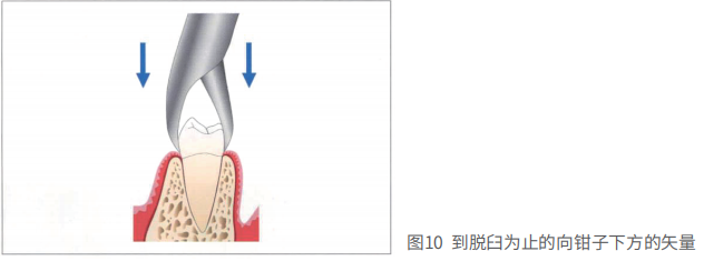 拔牙的细致流程详解