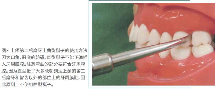 拔牙的细致流程详解