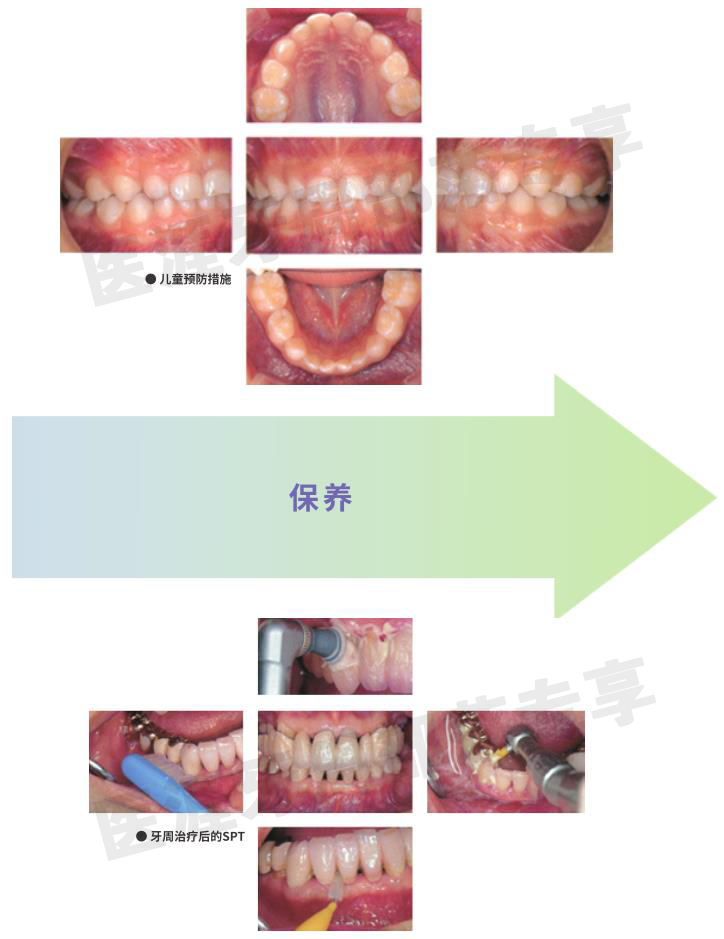 洁牙要哪些器材PMTC各种仪器、器材的选择_https://www.jmylbn.com_新闻资讯_第5张