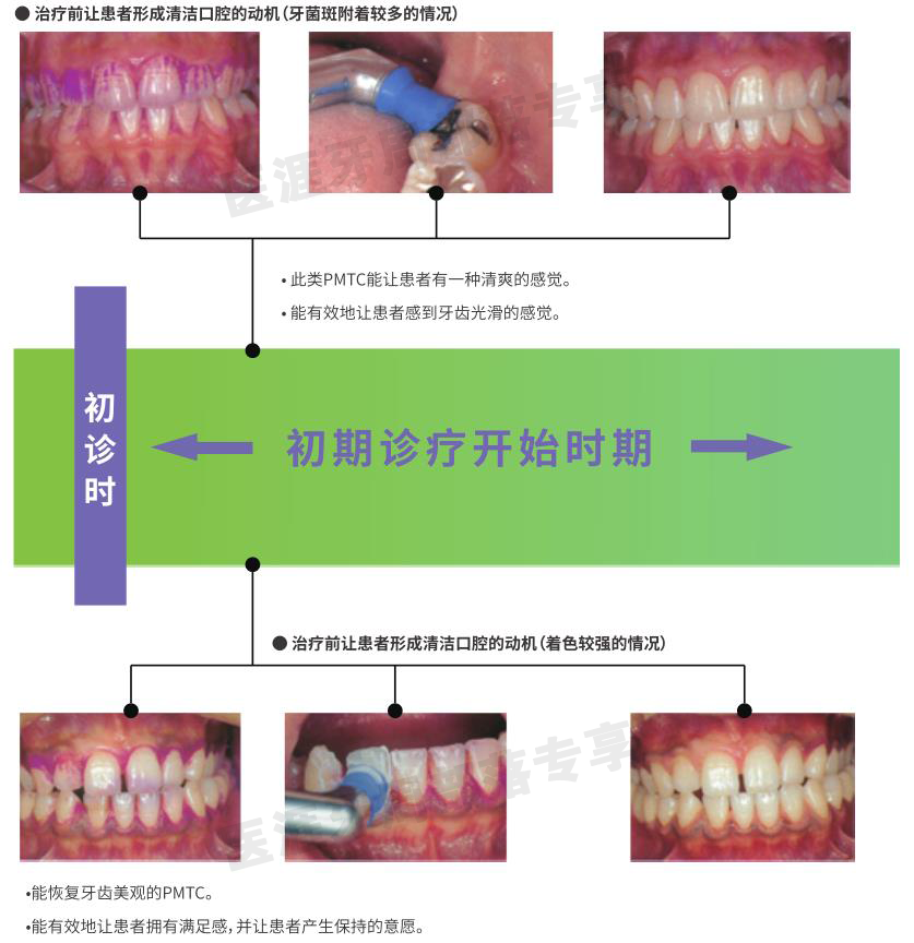 洁牙要哪些器材PMTC各种仪器、器材的选择_https://www.jmylbn.com_新闻资讯_第2张