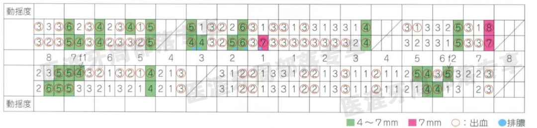怎么选洁牙器械5个要点带你学习器械洁牙_https://www.jmylbn.com_新闻资讯_第38张