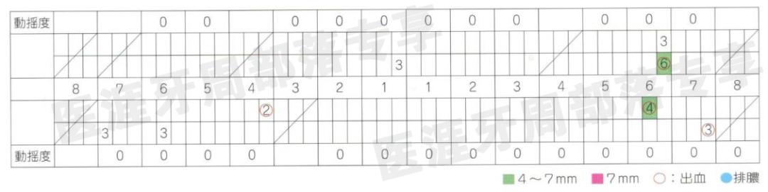 怎么选洁牙器械5个要点带你学习器械洁牙_https://www.jmylbn.com_新闻资讯_第41张