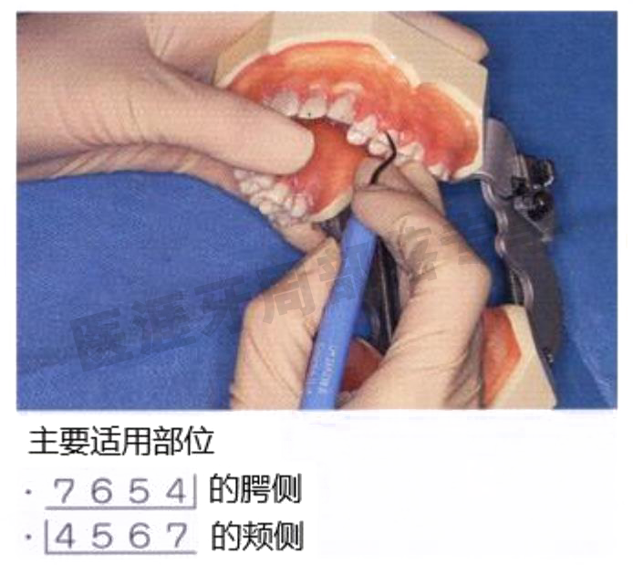 怎么选洁牙器械5个要点带你学习器械洁牙_https://www.jmylbn.com_新闻资讯_第11张