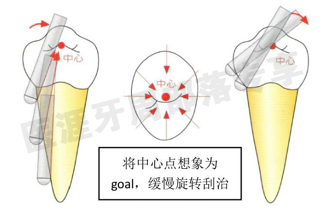 怎么选洁牙器械5个要点带你学习器械洁牙_https://www.jmylbn.com_新闻资讯_第31张