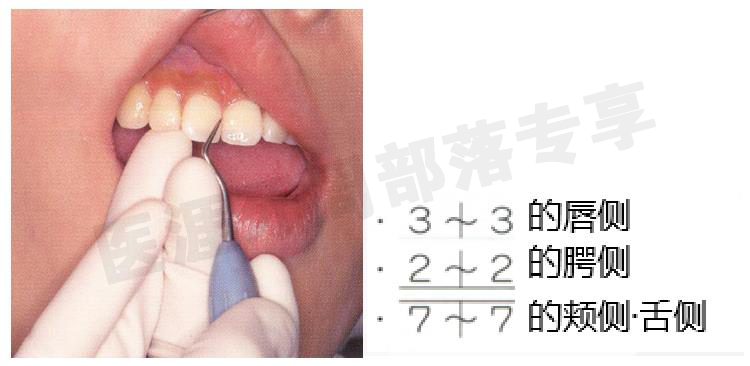 怎么选洁牙器械5个要点带你学习器械洁牙_https://www.jmylbn.com_新闻资讯_第13张