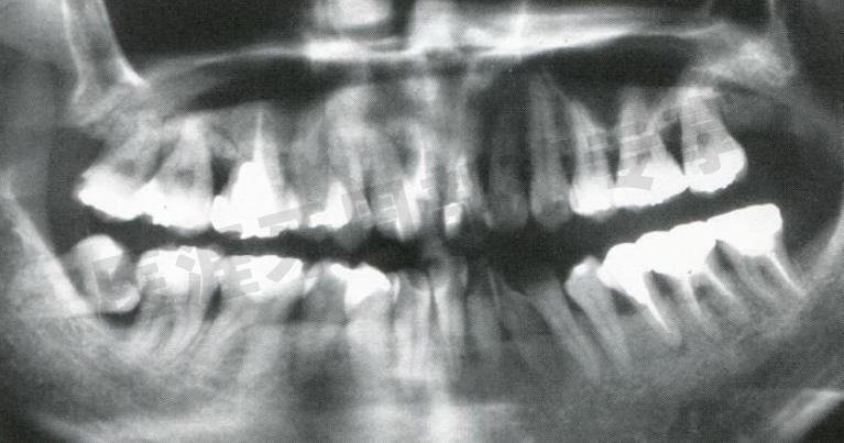 怎么选洁牙器械5个要点带你学习器械洁牙_https://www.jmylbn.com_新闻资讯_第37张