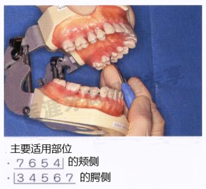 怎么选洁牙器械5个要点带你学习器械洁牙_https://www.jmylbn.com_新闻资讯_第10张