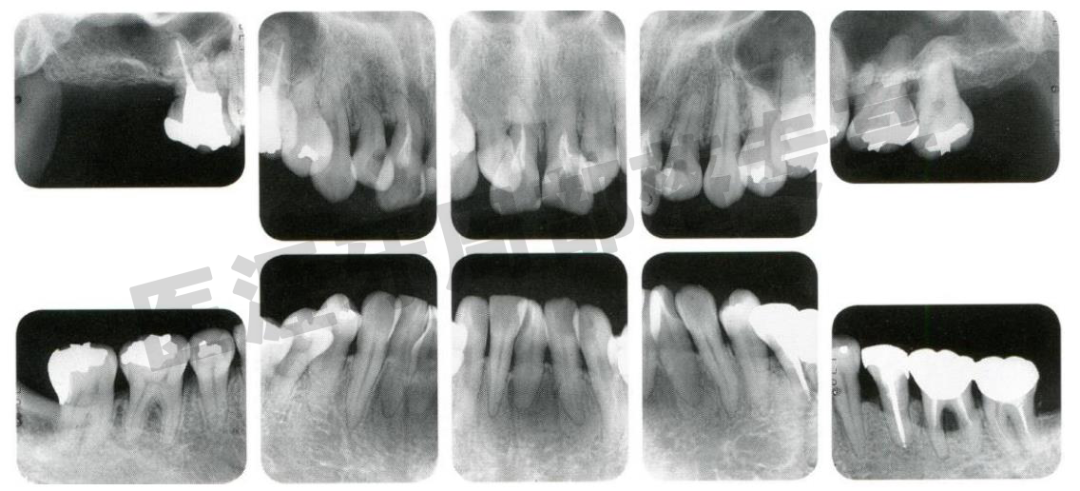 怎么选洁牙器械5个要点带你学习器械洁牙_https://www.jmylbn.com_新闻资讯_第40张