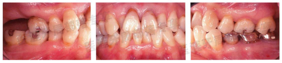 怎么选洁牙器械5个要点带你学习器械洁牙_https://www.jmylbn.com_新闻资讯_第39张
