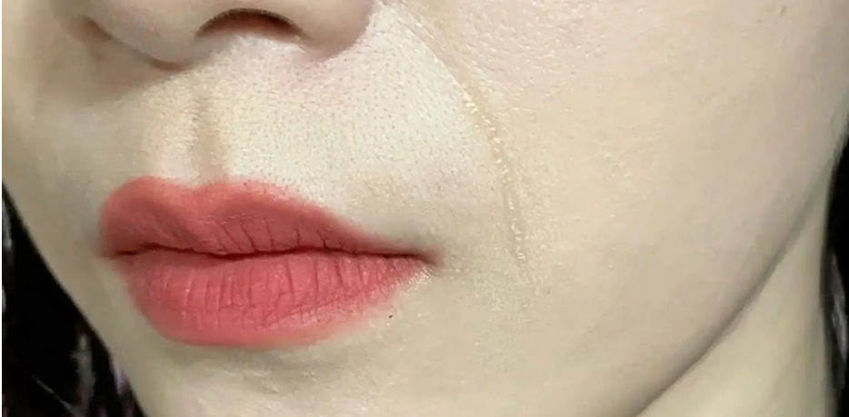 斑小将护肤 | 不用医美,这个超简单的办法也能改善法令纹!