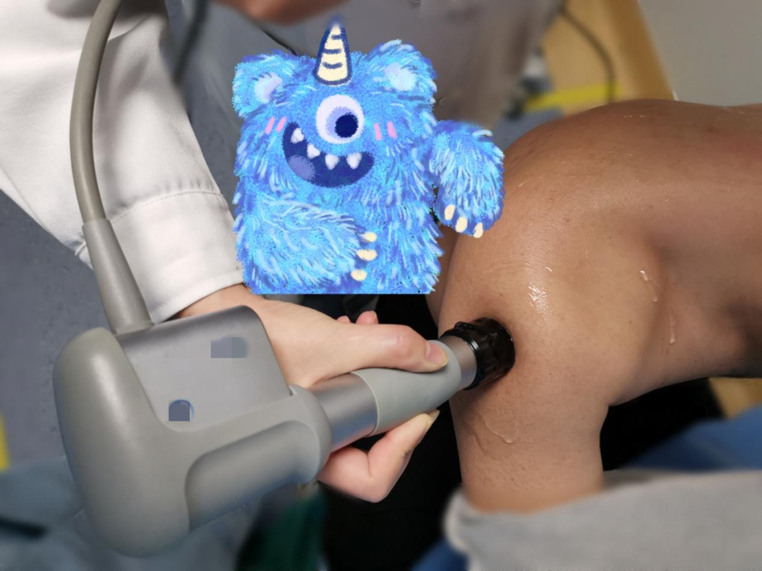 冲击波治疗效果怎么样冲击波疗法的原理、作用和适应症_https://www.jmylbn.com_新闻资讯_第9张