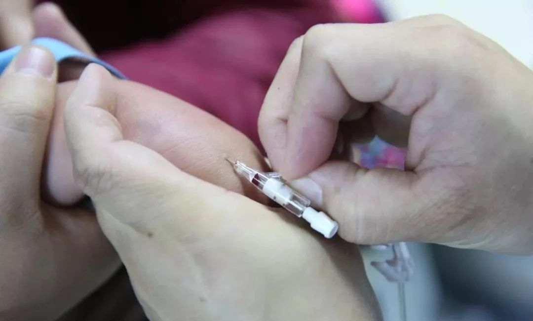 留置针绷带怎么缠收藏 ｜ 单手退针，护士必备技能！你学会了吗？_https://www.jmylbn.com_新闻资讯_第3张