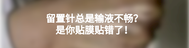 体表导管固定怎么使用护士巧用3M胶布制作了各类型的导管固定贴（安心贴）_https://www.jmylbn.com_新闻资讯_第12张