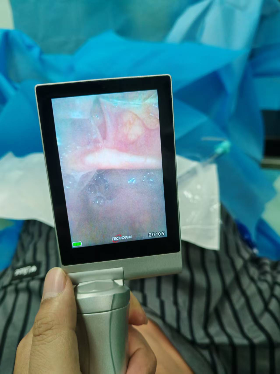 为什么要用可视喉镜【健康宣教】可视喉镜在困难气道的应用_https://www.jmylbn.com_新闻资讯_第3张