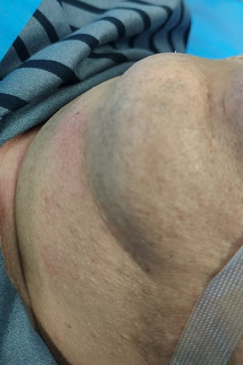 为什么要用可视喉镜【健康宣教】可视喉镜在困难气道的应用_https://www.jmylbn.com_新闻资讯_第1张