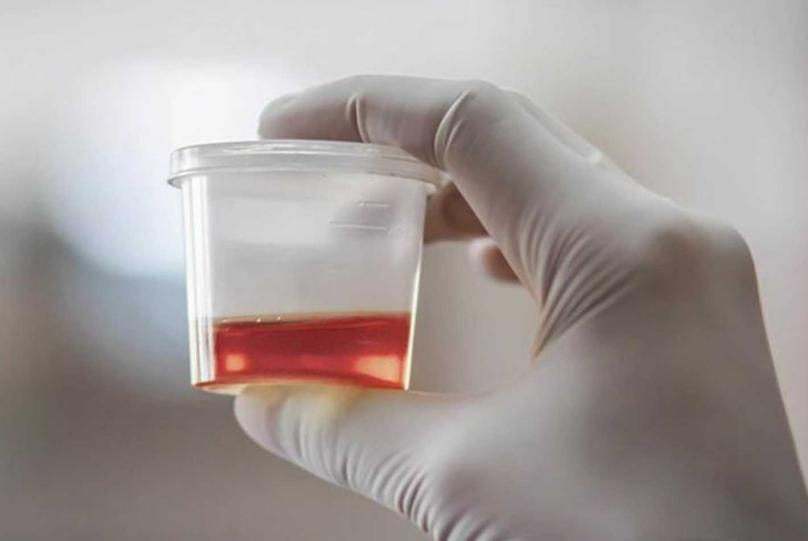 前列腺机器怎么治疗品质医疗丨我院泌尿外科成功实施高难度机器人辅助膀胱癌根治+回肠膀胱术_https://www.jmylbn.com_新闻资讯_第7张