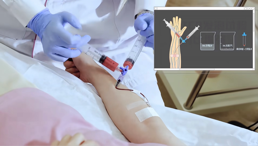 彩色经颅多普勒是什么健康有约丨揭秘脑血管的“侦察兵”——经颅多普勒超声(TCD)_https://www.jmylbn.com_新闻资讯_第11张