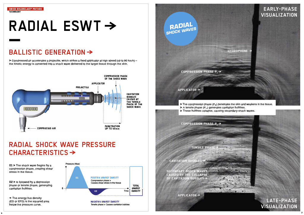 压力波是什么波关于洽圩压力波治疗仪的总结_https://www.jmylbn.com_新闻资讯_第9张