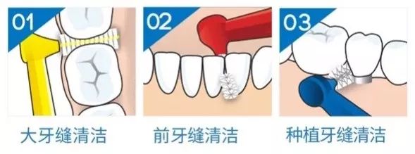 保護口腔衛生的利器，你會挑選嗎？ 健康 第5張