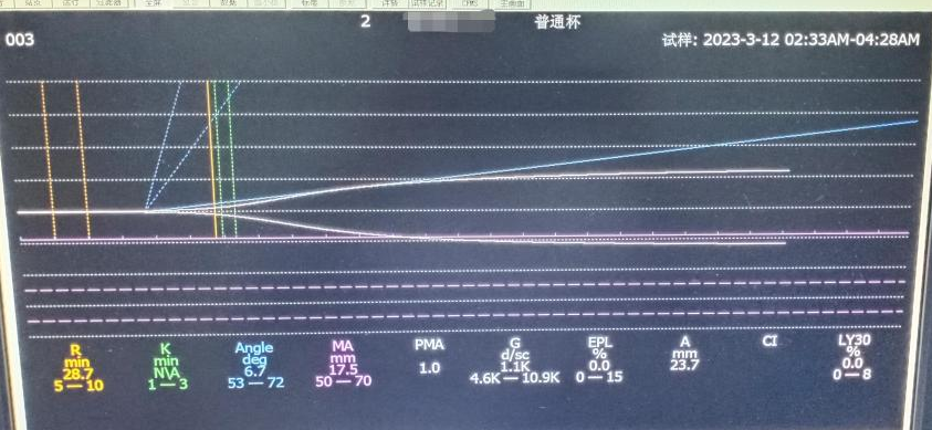 凝血4000怎么办【检验医学20】和“血栓弹力图”相识的一天🤚_https://www.jmylbn.com_新闻资讯_第8张