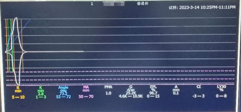 凝血4000怎么办【检验医学20】和“血栓弹力图”相识的一天🤚_https://www.jmylbn.com_新闻资讯_第3张
