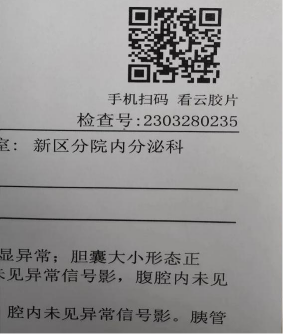 什么科需要胶片云胶片时代——甘肃省人民医院兰州新区分院放射科“数字智能胶片系统”上线啦！-上海聚慕医疗器械有限公司