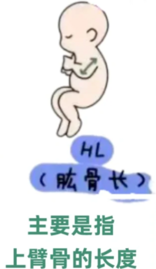 眼科ab超单怎么看1分钟带你看懂孕检B超单，解读秘籍准妈妈必备！_https://www.jmylbn.com_新闻资讯_第12张