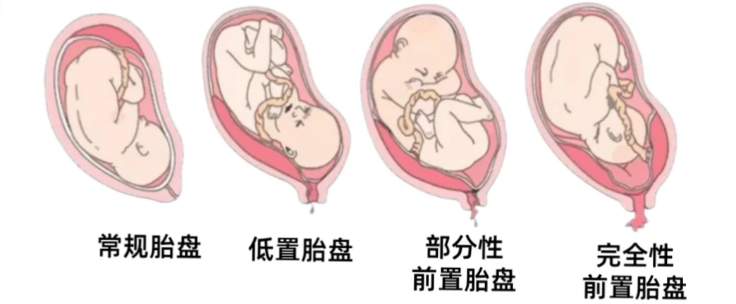 眼科ab超单怎么看1分钟带你看懂孕检B超单，解读秘籍准妈妈必备！_https://www.jmylbn.com_新闻资讯_第14张