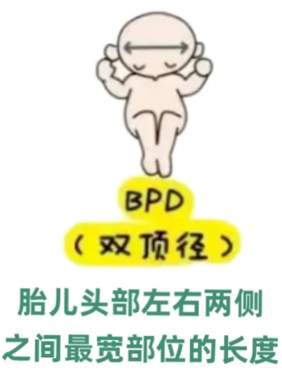 眼科ab超单怎么看1分钟带你看懂孕检B超单，解读秘籍准妈妈必备！_https://www.jmylbn.com_新闻资讯_第6张