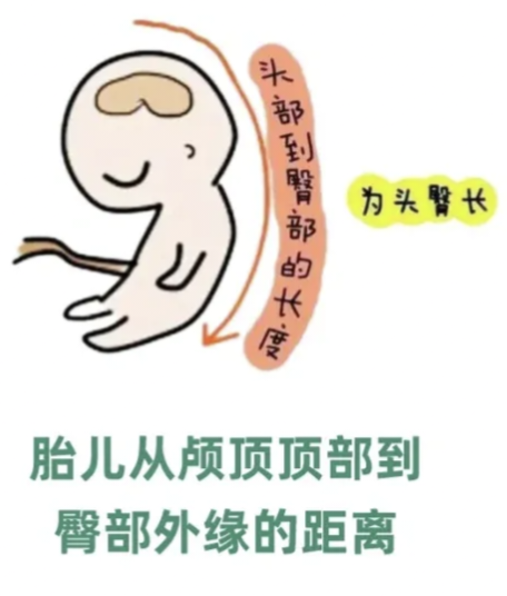 眼科ab超单怎么看1分钟带你看懂孕检B超单，解读秘籍准妈妈必备！_https://www.jmylbn.com_新闻资讯_第11张