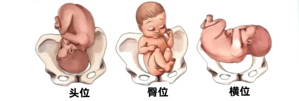 眼科ab超单怎么看1分钟带你看懂孕检B超单，解读秘籍准妈妈必备！_https://www.jmylbn.com_新闻资讯_第13张